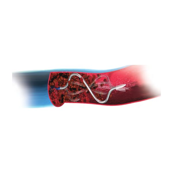 CLEANER XT & CLEANER 15 Rotational Thrombectomy System